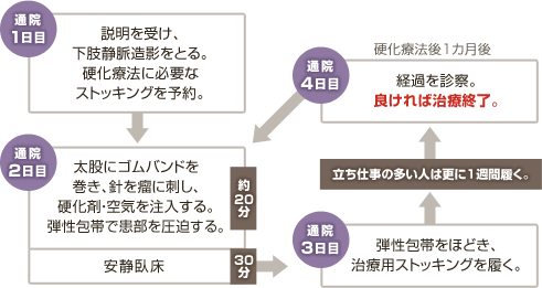 下肢静脈瘤治療の流れ