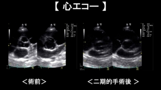 退院後の検査・その後のご連絡