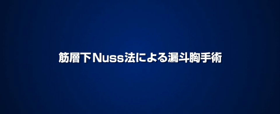 バーを入れる手術（Nuss法一期的手術）